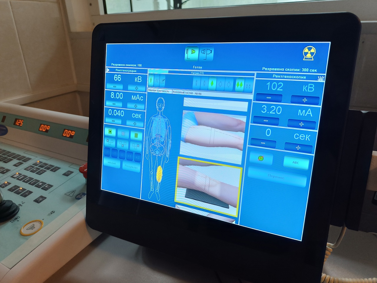 
В поликлинике Усинска после двух лет простоя запустили рентген-аппарат