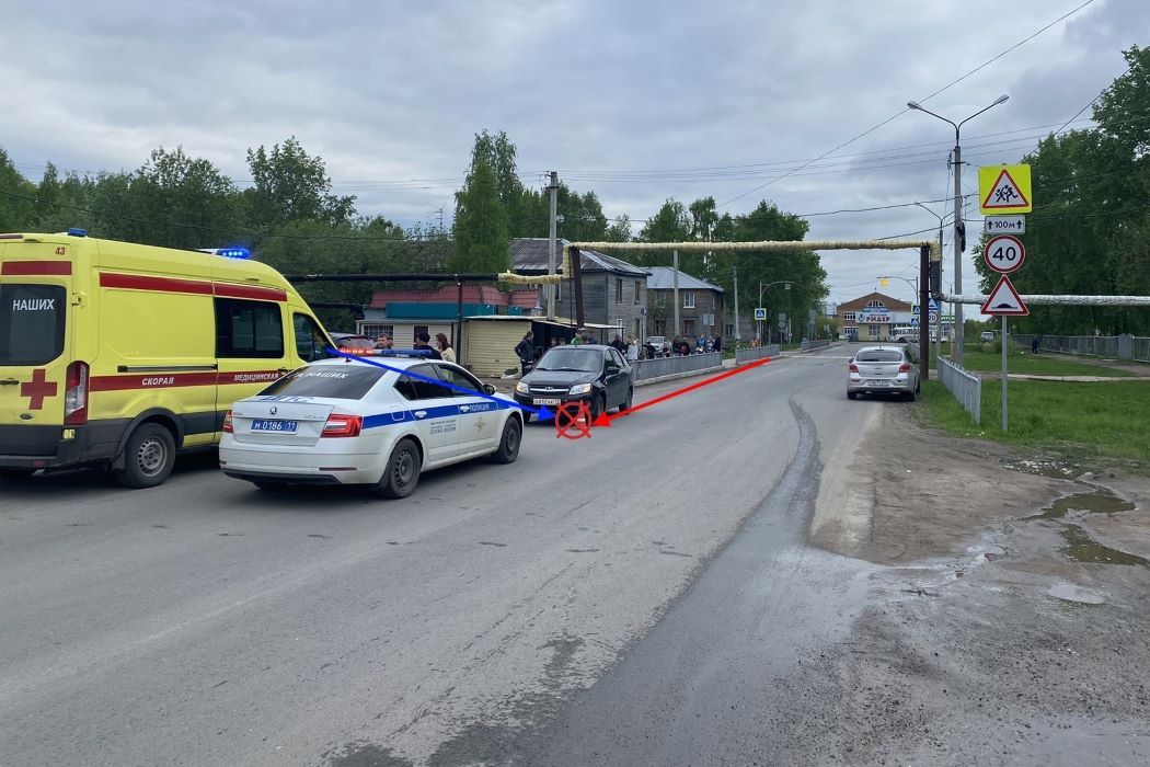 В Сыктывкаре ребенок на велосипеде попал под колеса «Лады»