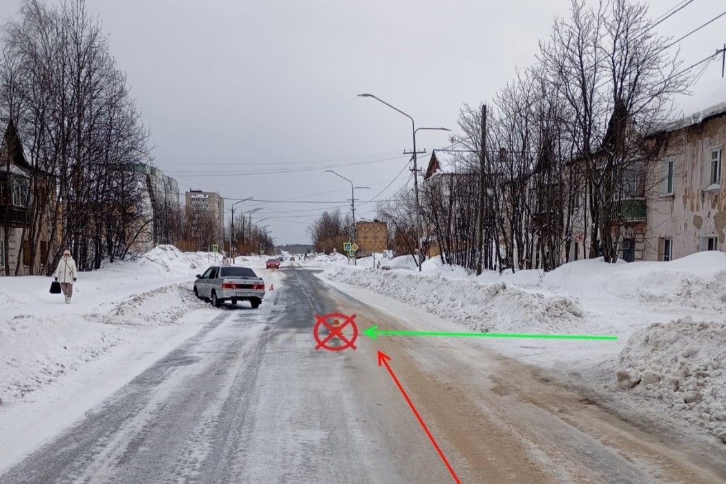 Переход дороги вне разрешенной зоны закончился для жительницы Печоры в больнице