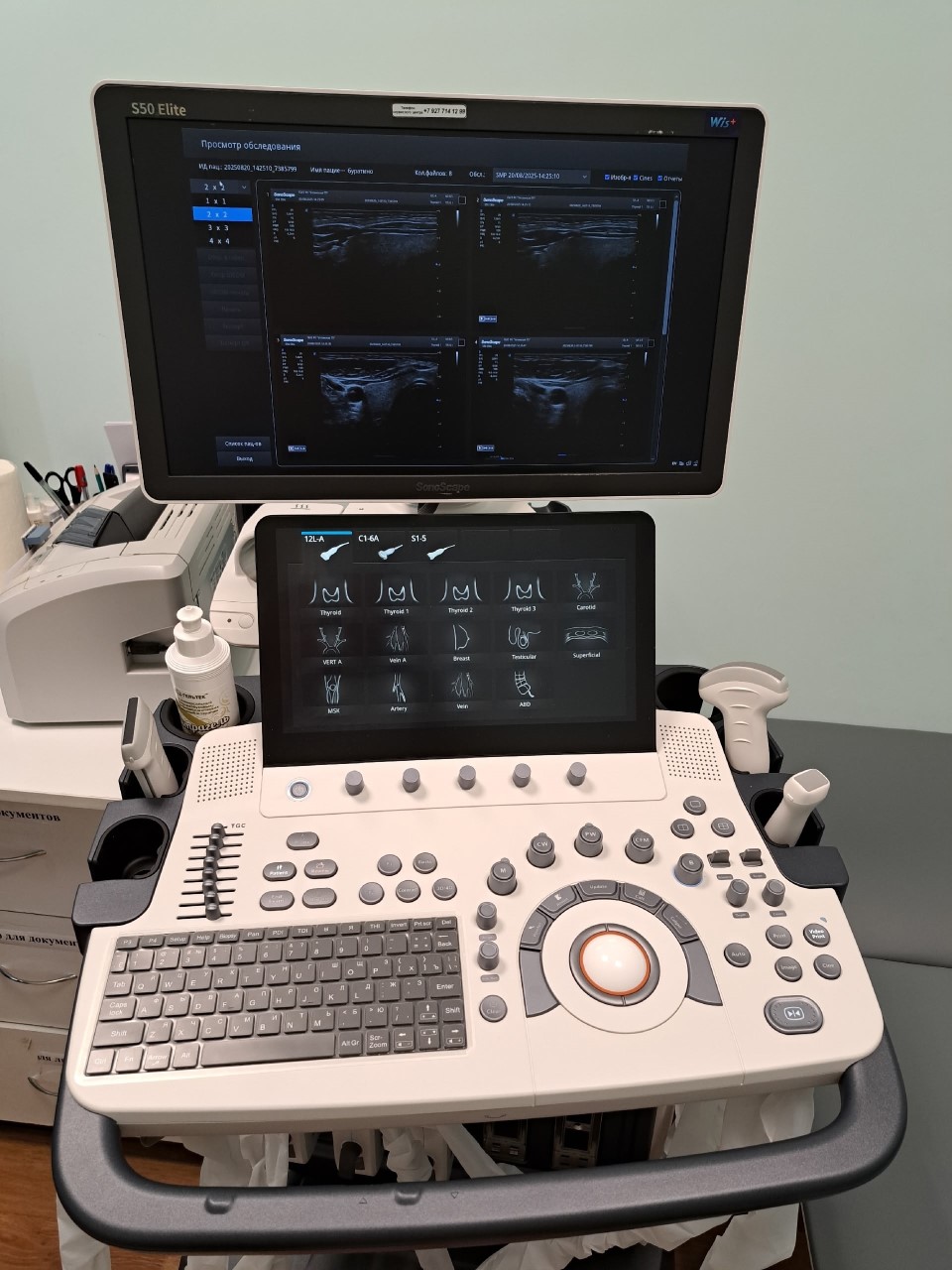 Точный диагноз — быстрее: в поликлинике Ухты заработал новый УЗИ-аппарат экспертного класса