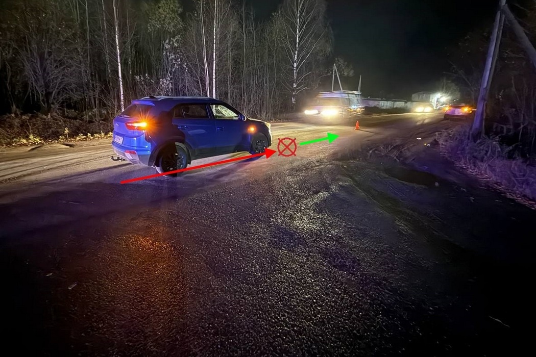 Мужчина получил открытый перелом, передвигаясь по проезжей части в Сыктывкаре