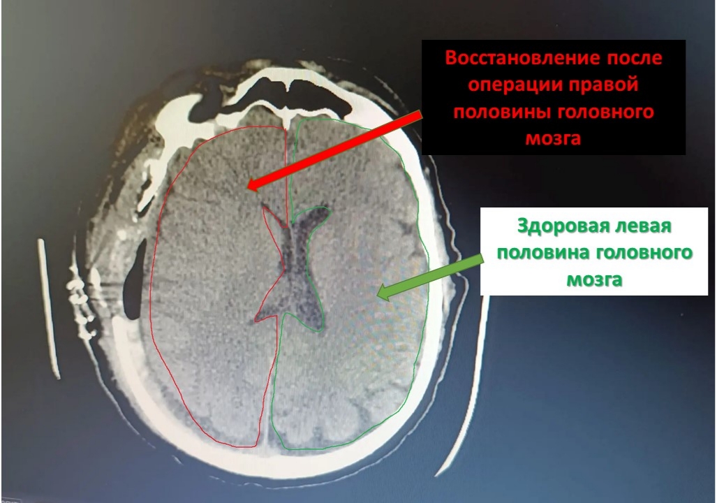 47aGiZKRBroQsw-wH4y66EzklKgrKJi2_w2s9oe5aDHo-PmTQkSFUMJwKJCc-2FEaTdftXgPfzBulNVBomIf_Ncg.jpg 47aGiZKRBroQsw-wH4y66EzklKgrKJi2_w2s9oe5aDHo-PmTQkSFUMJwKJCc-2FEaTdftXgPfzBulNVBomIf_Ncg.jpg