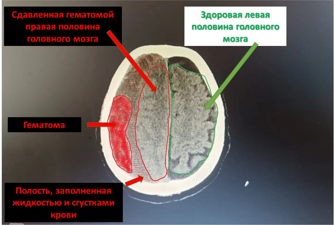 X4aPKtsHji4gDWpoHqGGPY87jFcSQvz7v2P5JKvvK1zt-Lx26F-1QsisZCXQNJE4_Pq3emQb5Jh6jhxdyookhDf1.jpg X4aPKtsHji4gDWpoHqGGPY87jFcSQvz7v2P5JKvvK1zt-Lx26F-1QsisZCXQNJE4_Pq3emQb5Jh6jhxdyookhDf1.jpg